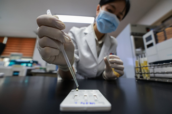 ▲ 지난 2월 1일 오전 서울 영등포구 서울지방병무청 제1병역판정검사장에서 임상병리사가 소변을 검체로 간이 검사 키트를 활용해 마약 검사를 하고 있다.