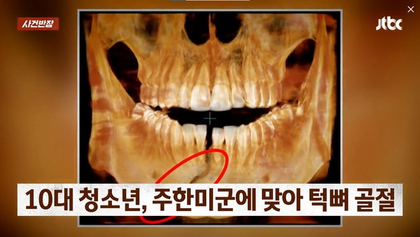 ▲ 2024년 11월 19일 JTBC 사건반장에 보도된 30대 주한미군 중사의 10대 소년 가격 사진.(사진=JTBC 사건반장 갈무리) /뉴시스