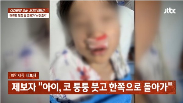 ▲ 태권도 대회에 참가한 아들이 경기 도중 코뼈가 부러졌는데 주최 측에서 아무런 조처를 하지 않았다며 아버지가 분통을 터뜨렸다. (사진=JTBC '사건반장') /뉴시스