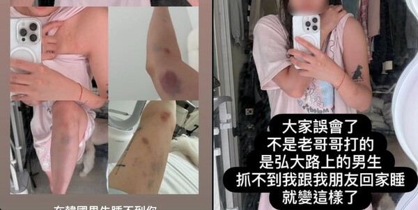 ▲ 구독자 46만명을 보유한 대만 유튜버 B씨는 친구와 서울 홍대 거리를 걷다 모르는 남성으로부터 폭행을 당했다고 주장하는 글을 게시했다. (사진=SNS 갈무리)